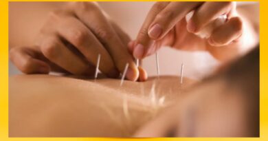 Korean Acupuncture